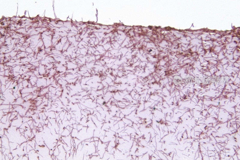 Microsporum Gypseum真菌